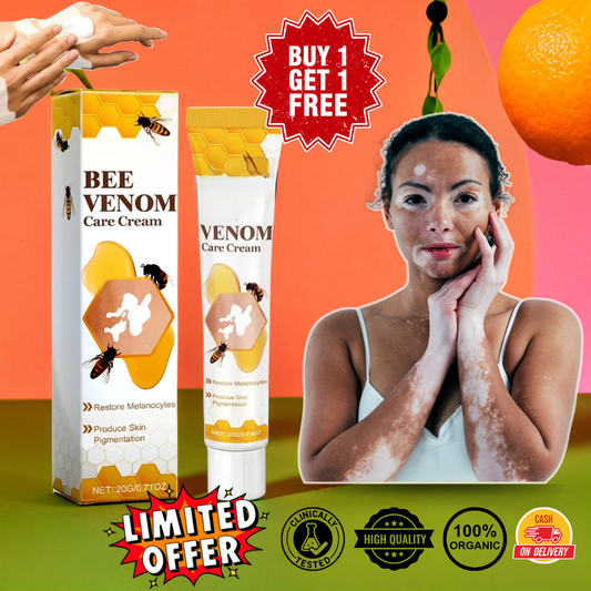 Bee Venom VitiGO Correcting Cream (Pack Of 2)